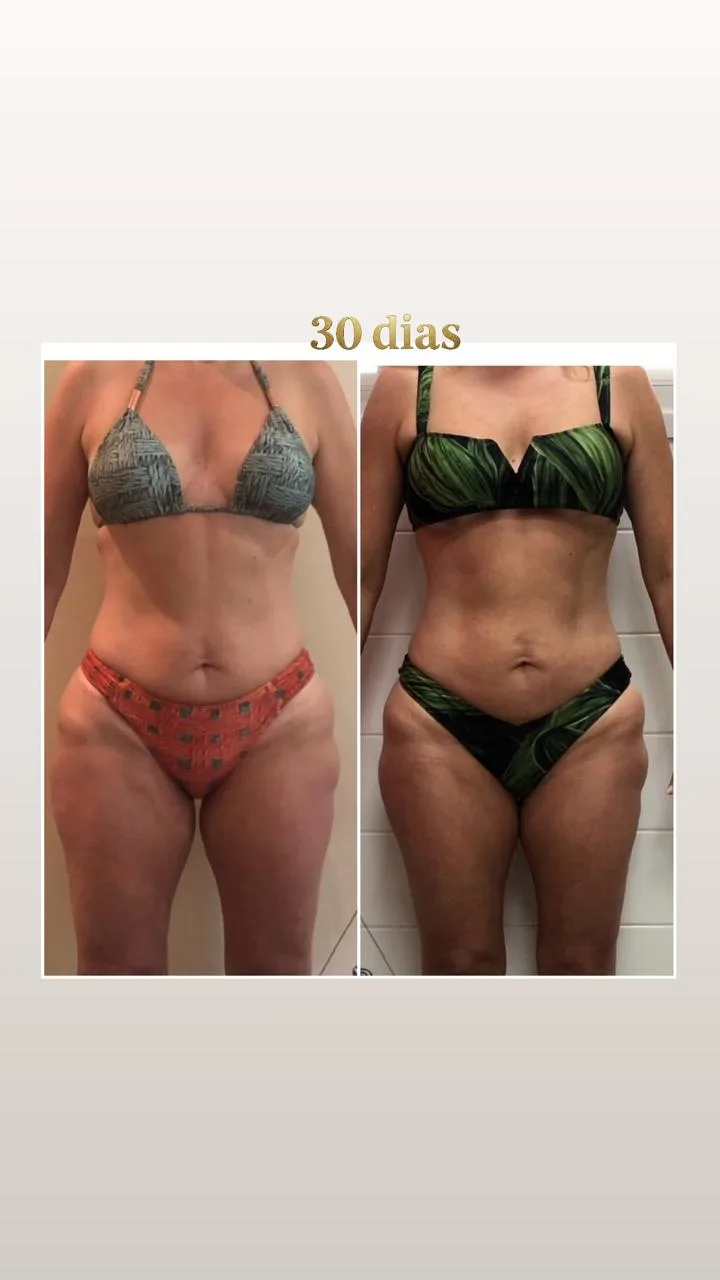 Antes e depois - emagrecimento com acompanhamento profissional SP
